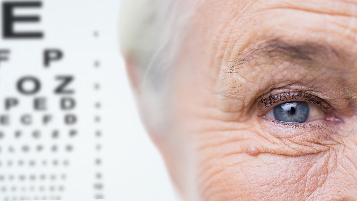 Eye of an older woman next to a blurry eye exam chart.