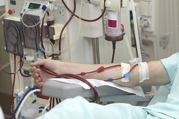 ESRD resident on dialysis